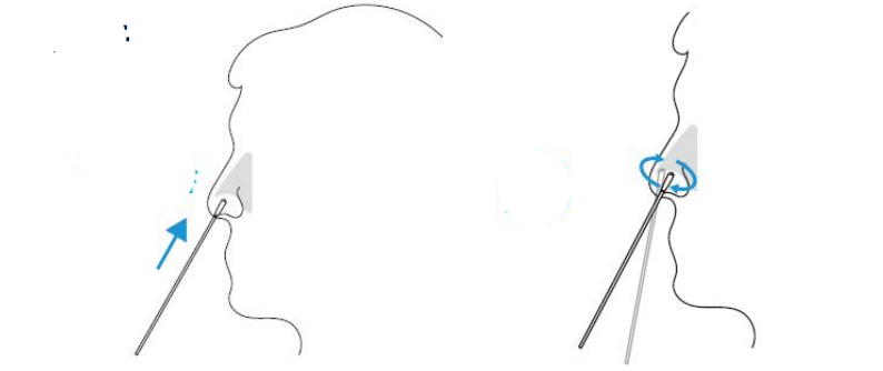 鼻咽拭子采樣示意圖