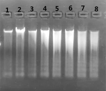 在1%的瓊脂糖凝膠上加入5 μl洗脫的唾液DNA進行電泳結果