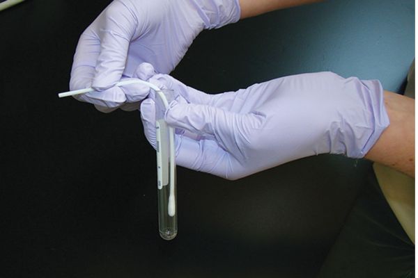 折斷點鼻咽拭子